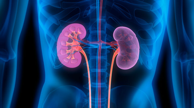 how-do-you-treat-kidney-disease-freesiteslike